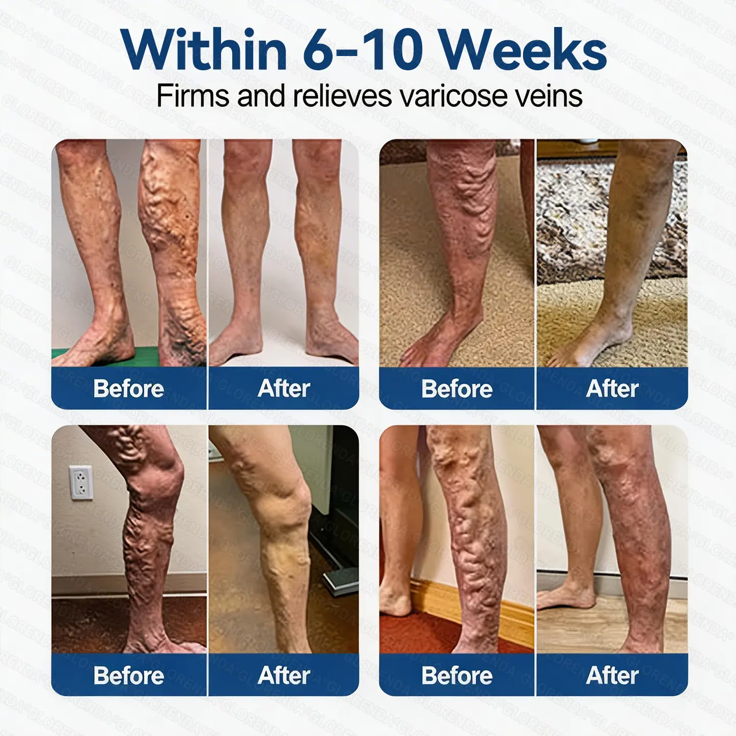 𝑽𝗲𝗶𝙣 𝘾𝐨𝐧𝘁𝗼𝙪𝙧 𝙈𝙞𝐜𝐫𝒐𝒏𝒆𝗲𝗱𝗹𝙚 𝙋𝙖𝐭𝐜𝒉 𝒘𝒊𝘁𝗵 𝗔𝙙𝙫𝙖𝙣𝙘𝐞𝐝 - Image 3