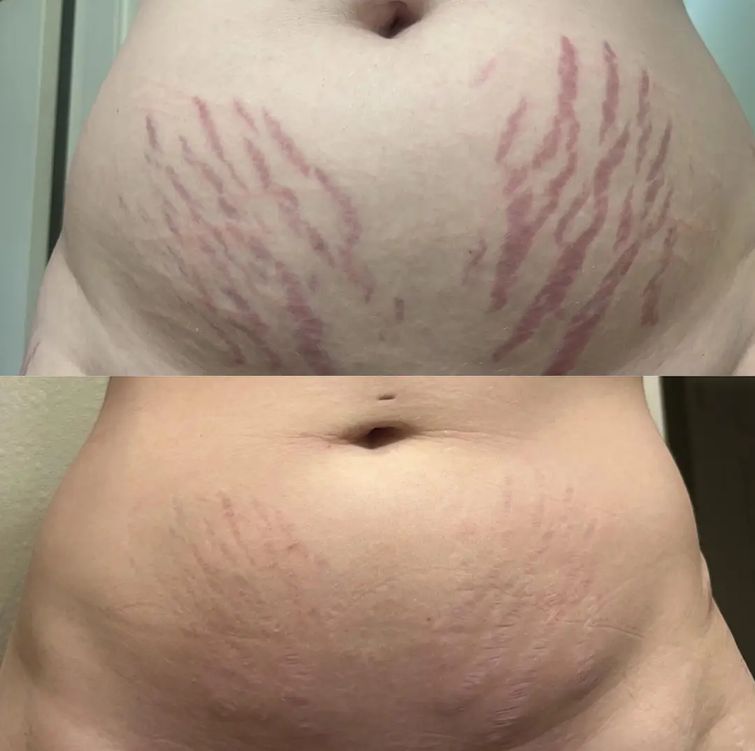 DermalRebuild Daily Renewal Gel - Image 7
