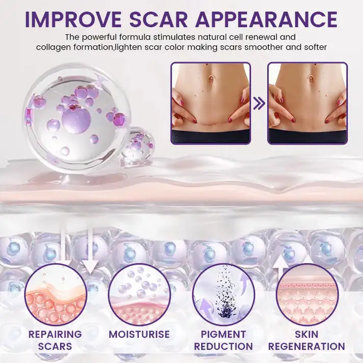 ReGenScar Rapid Recovery Scar Gel - Image 2