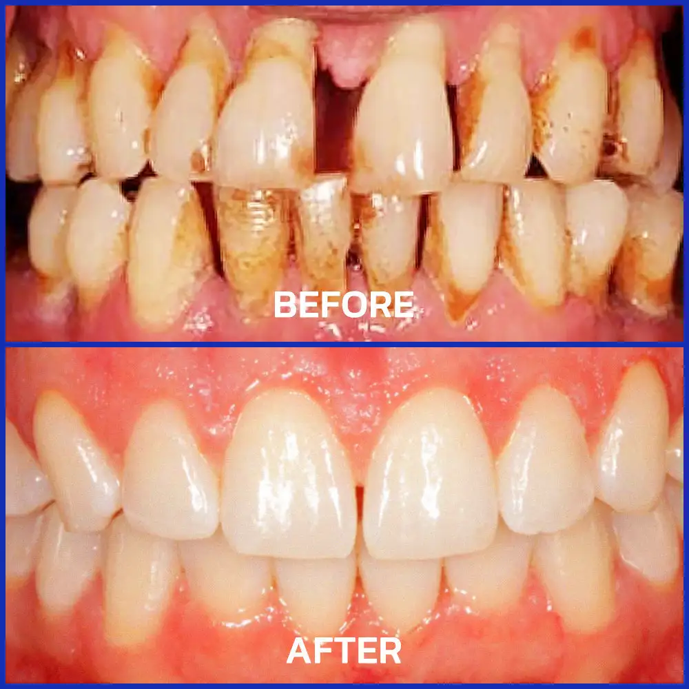 VioCore Dental Treatment Toothpaste - Image 9
