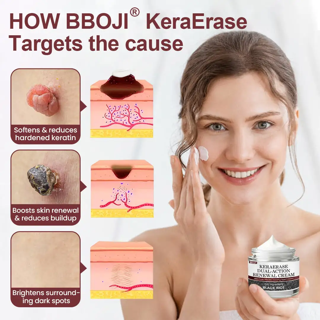 KeraErase Smoothing Dual-Action Renewal Cream - Image 2