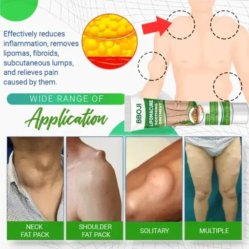 LipomaCure Soothing Ointment - Image 7