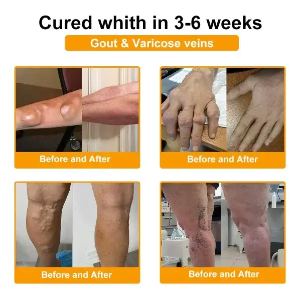 Botulinum Toxin & Bee Venom Pain-Relief Bone Healing Cream - Image 16