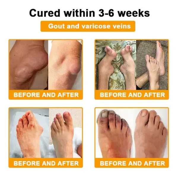 Botulinum Toxin & Bee Venom Pain-Relief Bone Healing Cream - Image 9