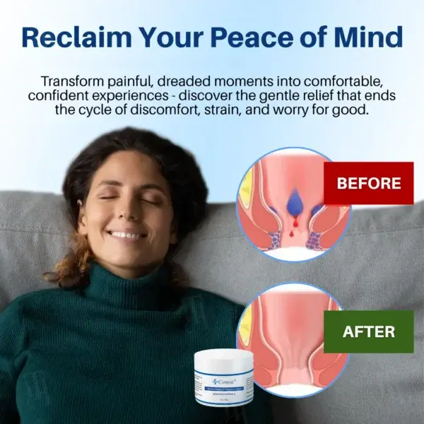 Hemorrhoid & Fissure Cream - Image 2