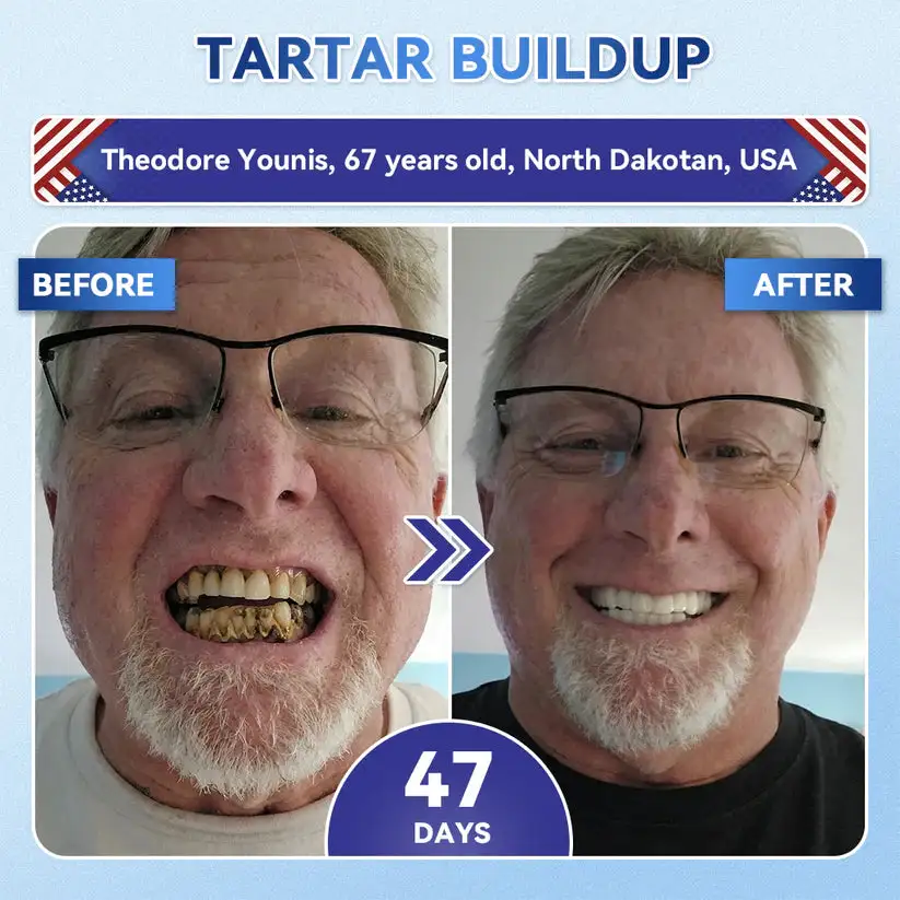 𝟓-𝒊𝒏-𝟏 𝑻𝒊𝒅𝒆𝒈𝒍𝒖𝒔𝒊𝒃 𝑻𝒐𝒐𝒕𝒉 𝑶𝒓𝒂𝒍 𝑺𝒕𝒓𝒊𝒑𝒔 & Gum Repair Oral Strips - Image 6