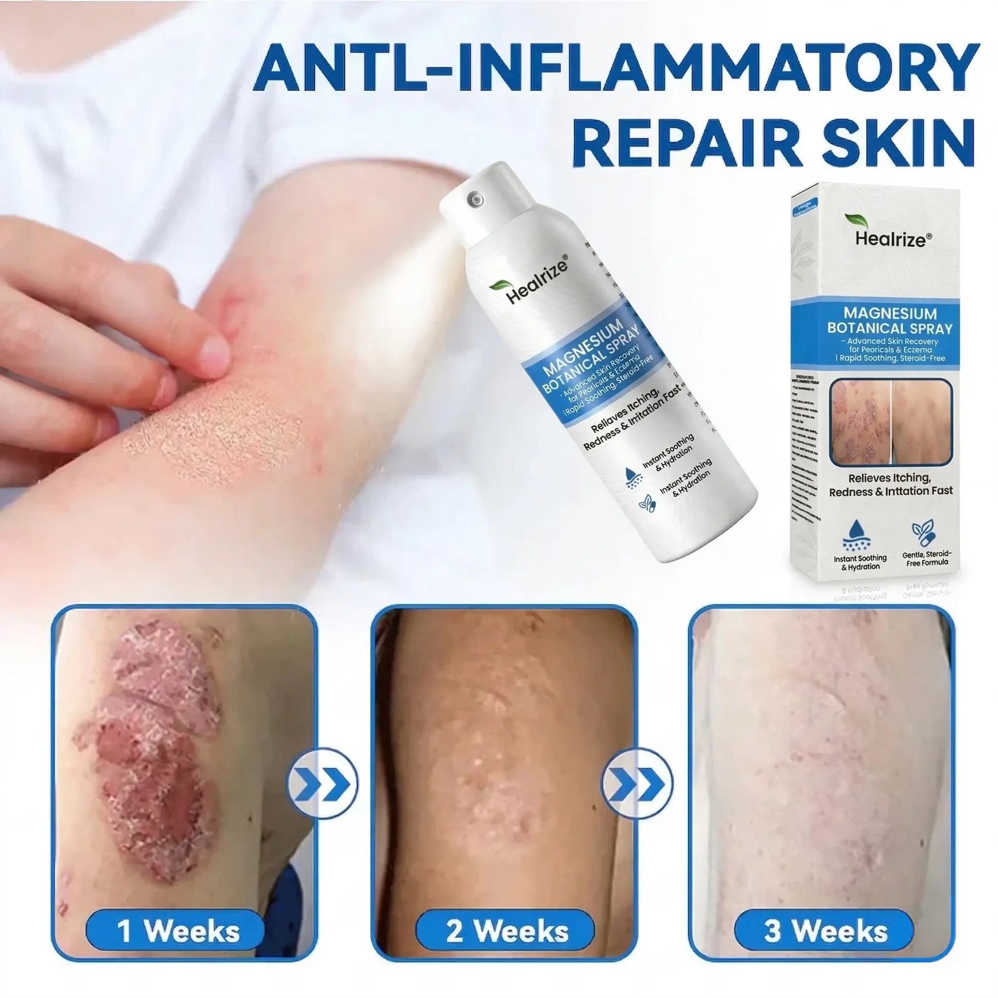Magnesium Botanical Spray –Advanced Skin Recovery for Psoriasis & Eczema - Image 3