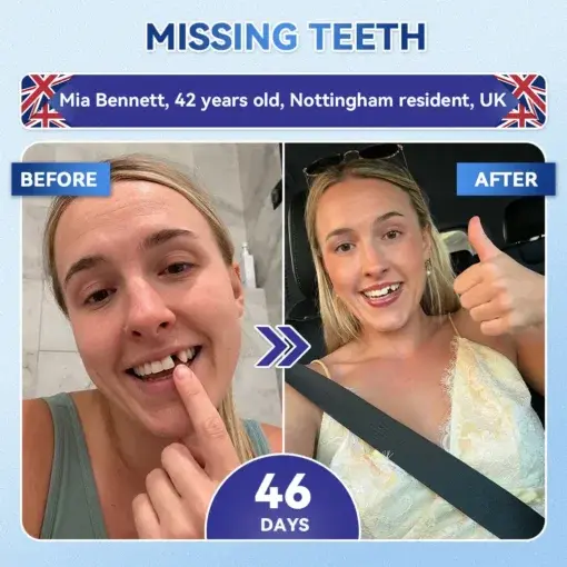 Tideglusib Fast‑Dissolving Tooth & Gum Repair Oral Strips - Image 2