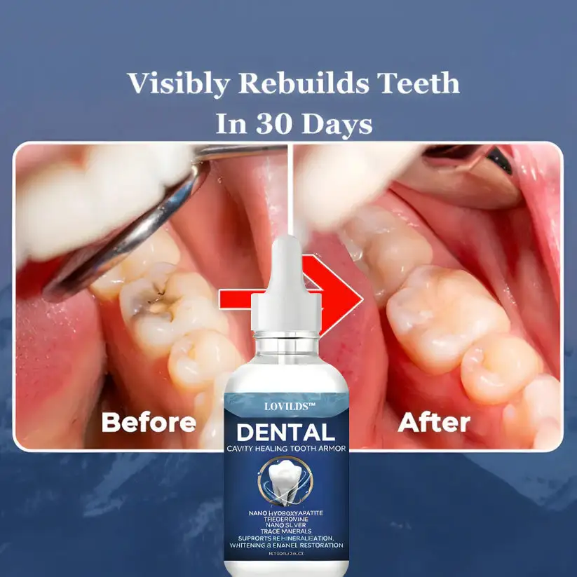 Enamel Repair & Teeth Whitening Kit - Image 5