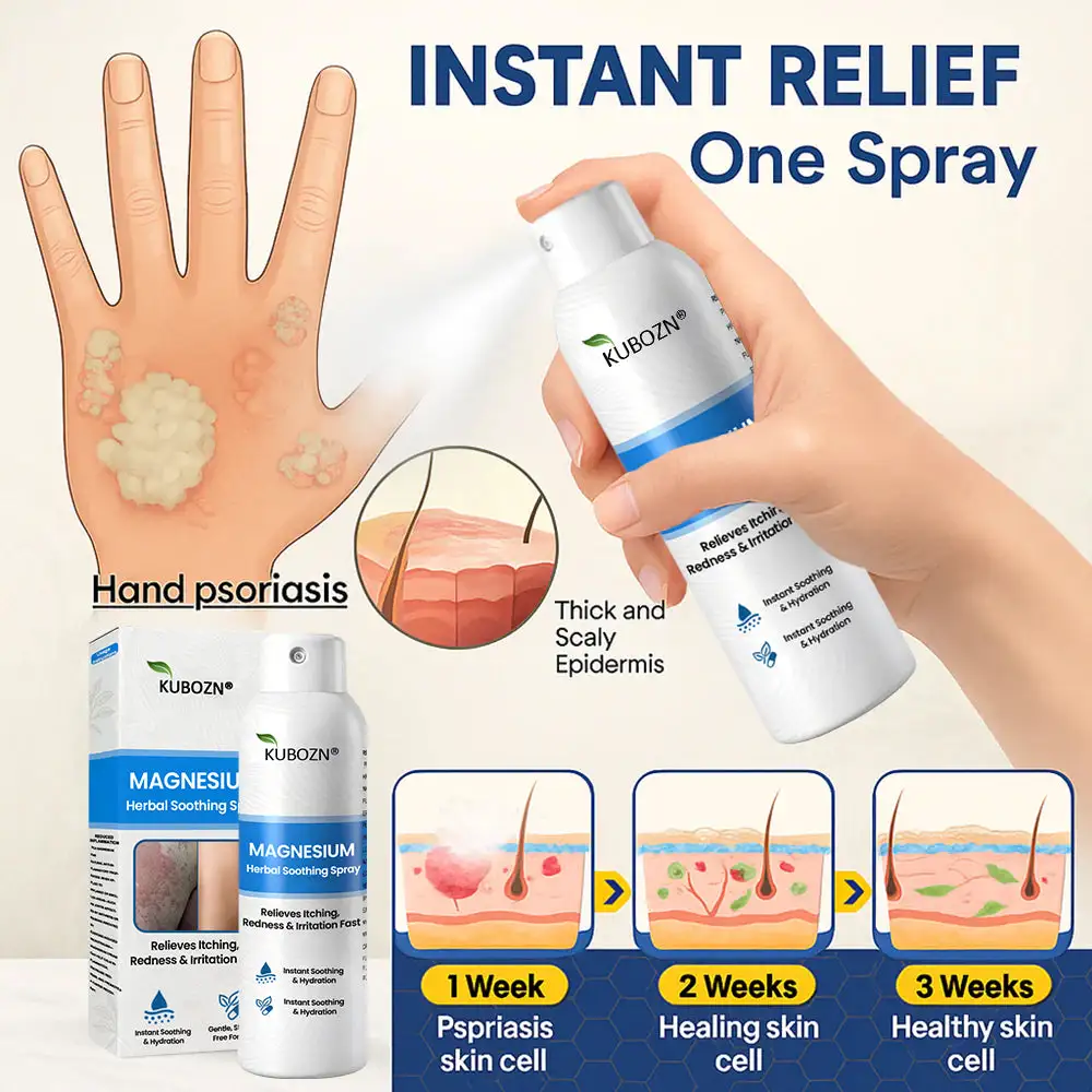 Magnesium Herbal Psoriasis Spray - Image 3