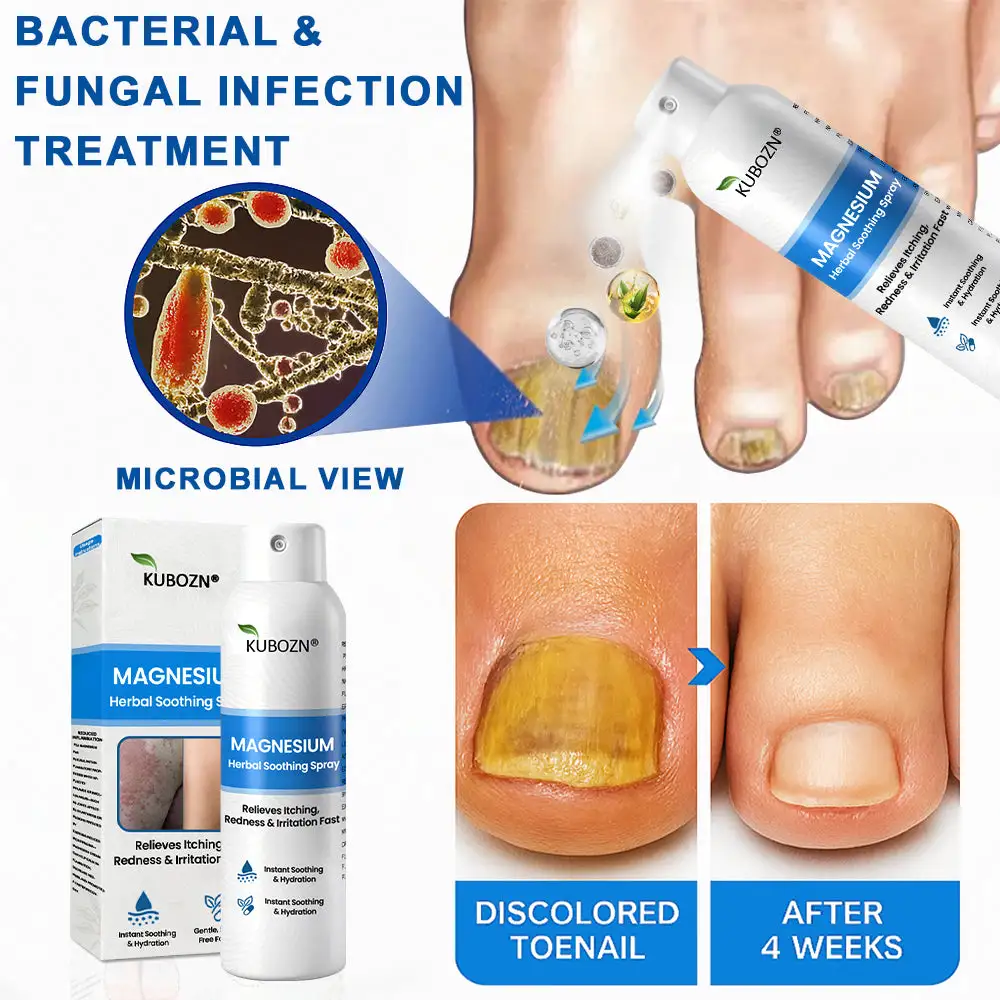 Magnesium Herbal Psoriasis Spray - Image 9