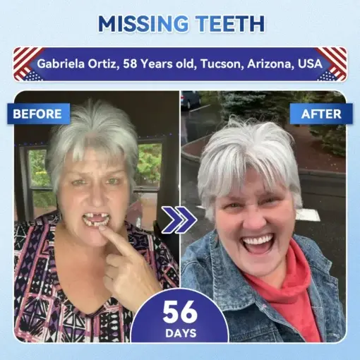 Tideglusib Fast‑Dissolving Tooth & Gum Repair Oral Strips - Image 2
