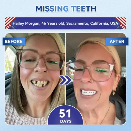 Tideglusib Fast‑Dissolving Tooth & Gum Repair Oral Strips - Image 3