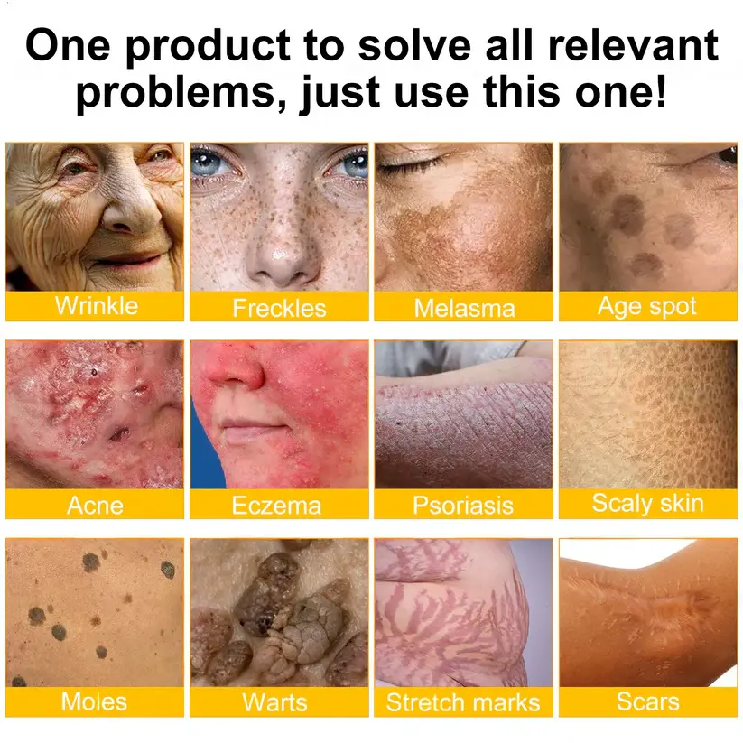USA’s #1 Bee Venom Skin Restoration Cream - Image 4