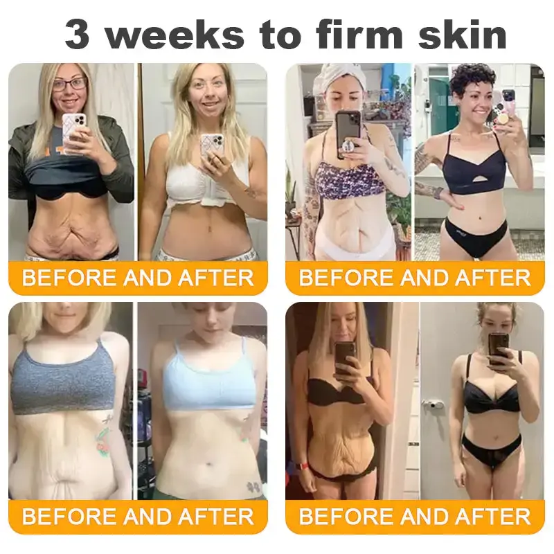 USA’s #1 Bee Venom Skin Restoration Cream - Image 9