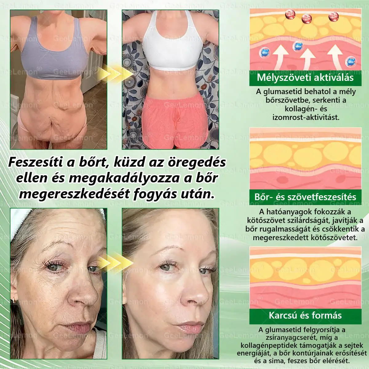 Glumasetide 8az 1-ben Karcsú és EgészségesNano Mikrotűs Tapasz - Image 11