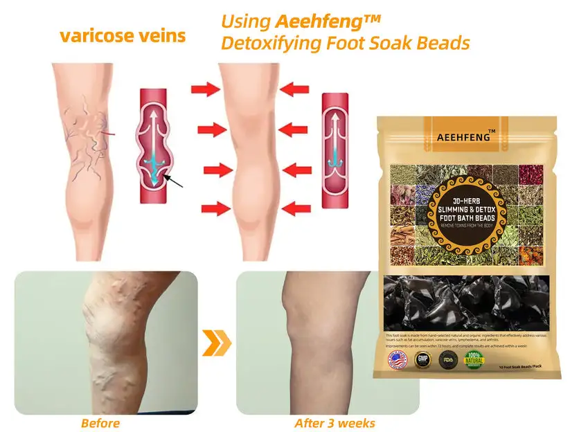 30-Herb Slimming & Detox Foot - Image 10