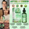 Natural Herbal Drops