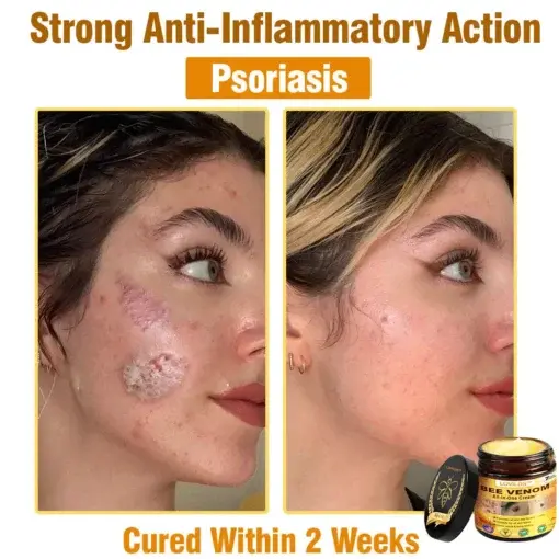 Bee Venom All-in-One Cream - Image 10