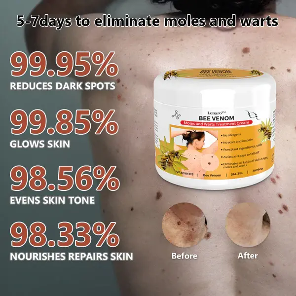 Bee Venom Mole and Wart Treatment Cream - Image 4