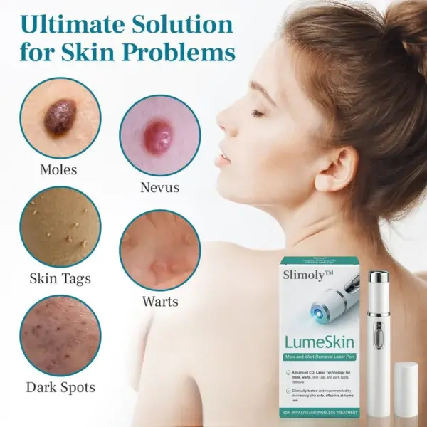 LumeSkin Mole and Wart Removal Laser Pen - Image 10