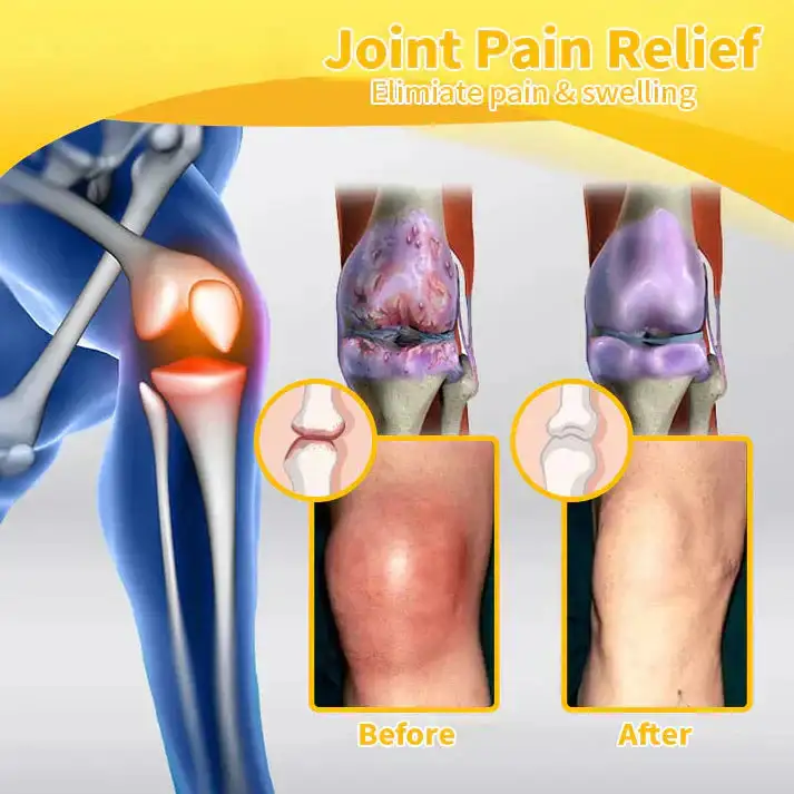 Lidocaine Arthritis Pain Relief Healing Gel - Image 13