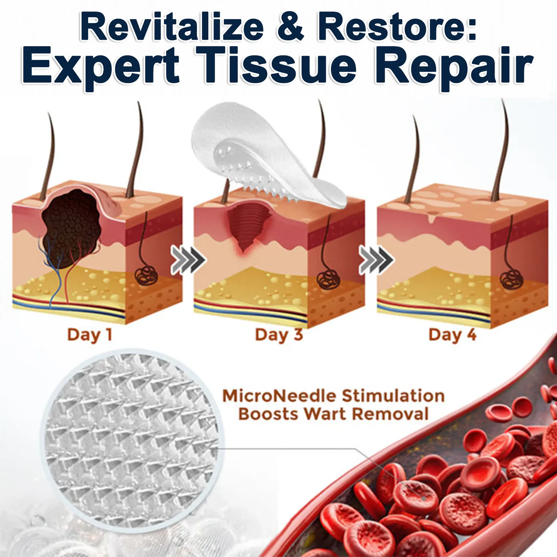 2-in-1 Microneedle & Hydrocolloid Patch - Image 7