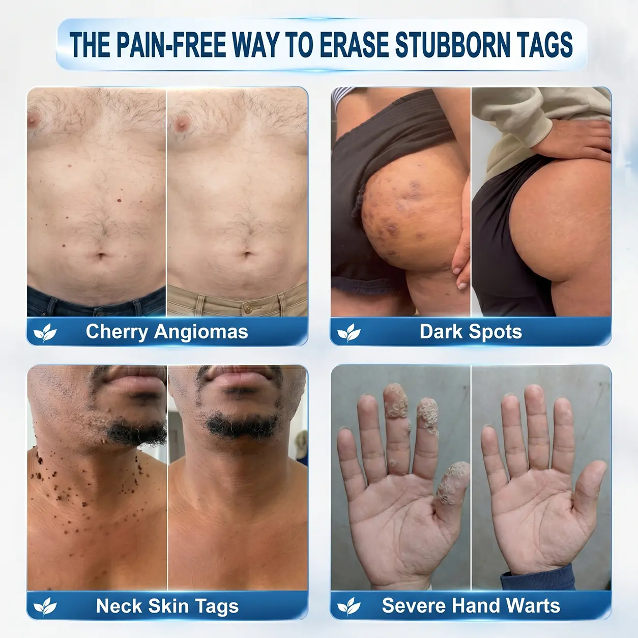 𝐔𝐩𝐠𝐫𝐚𝐝𝐞𝐝 𝟕-𝐃𝐚𝐲 𝐓𝐚𝐠 & 𝐒𝐩𝐨𝐭 𝐄𝐫𝐚𝐬𝐞𝐫 𝐑𝐨𝐥𝐥𝐞𝐫 - Image 3