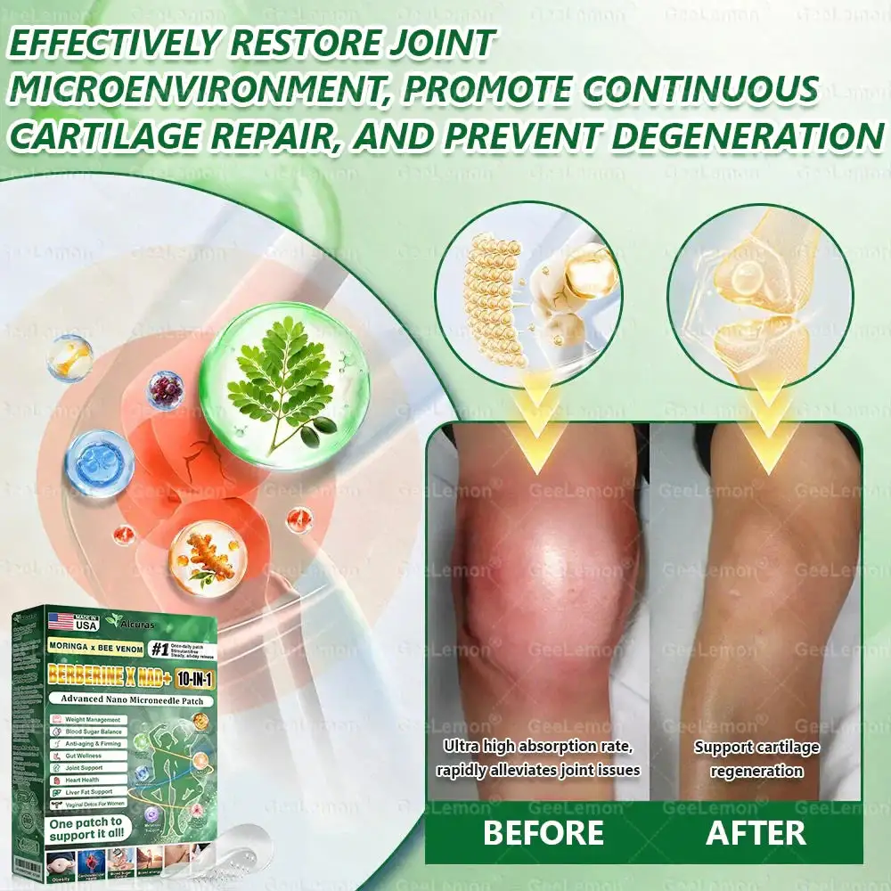 Moringa · Berberine × NAD+ 𝟏𝟎-𝐢𝐧-𝟏 𝐀𝐝𝐯𝐚𝐧𝐜𝐞𝐝 𝐍𝐚𝐧𝐨 𝐌𝐢𝐜𝐫𝐨𝐧𝐞𝐞𝐝𝐥𝐞 𝐏𝐚𝐭𝐜𝐡 - Image 12