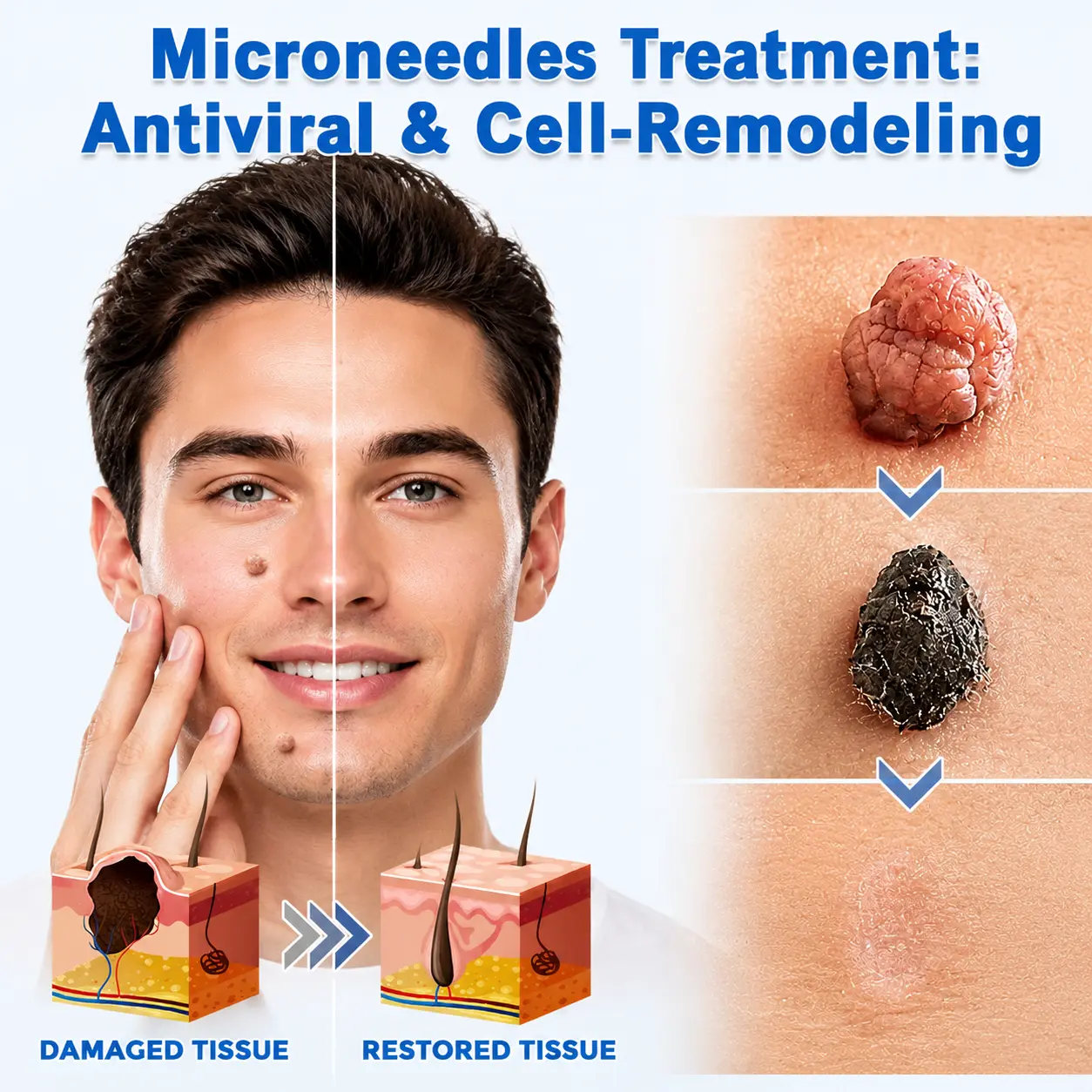 2-in-1 Microneedle & Hydrocolloid Patch - Image 4