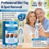7-Day Skin Tag & Spot Remover Serum