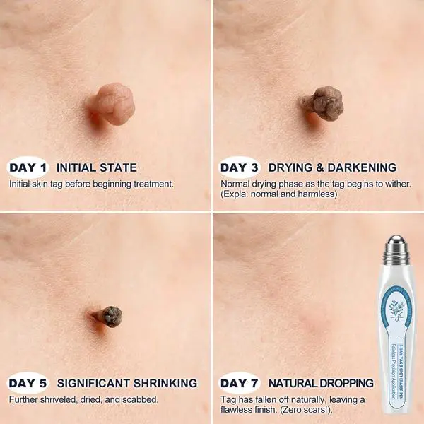 Official Store7-𝐷𝑎𝑦 𝗧𝐚𝐠 & 𝗦𝗽𝐨𝐭 𝐄𝐫𝒂𝒔𝒆𝒓 - Image 4