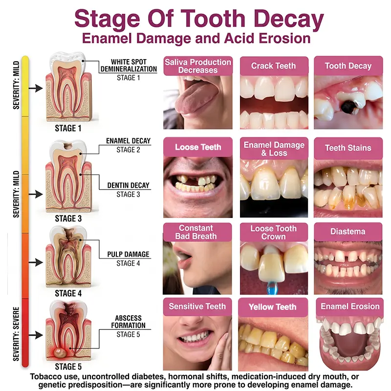 Cavity-Repair Natural Enamel Filling Gel - Image 6