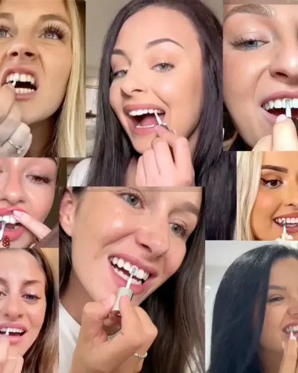Tooth Polish – Instant White Smile - Image 5