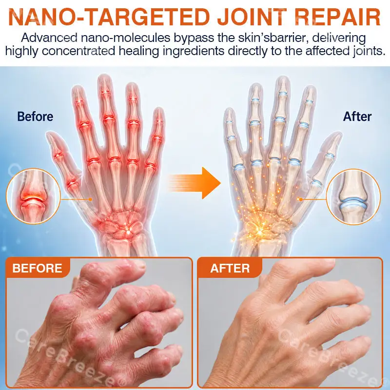 Pain-Relief Bone-Healing Microneedle Patch - Image 8