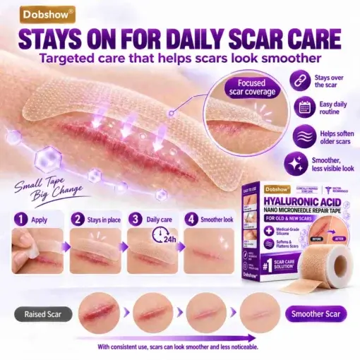 Medical-Grade Nano Microneedle Scar Repair Tape - Image 5