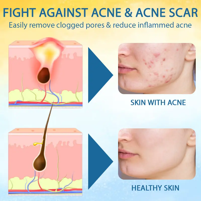 PsoriasisCare Mellifera Venom Skin Healing Spray - Image 6