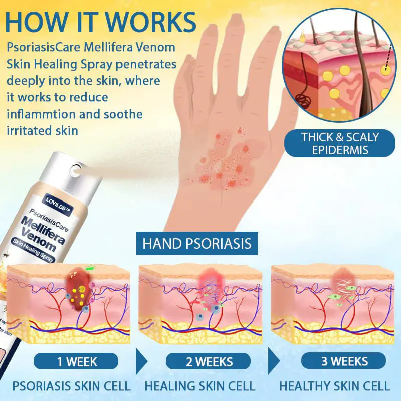 PsoriasisCare Mellifera Venom Skin Healing Spray - Image 9