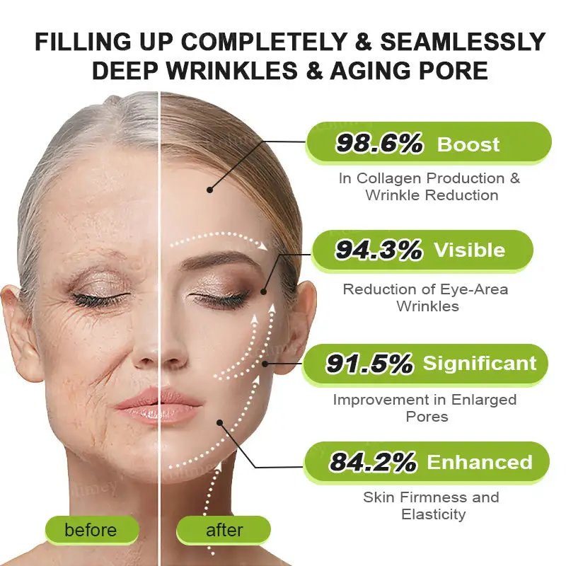 Botox & Vita-A Retinol Shot Wrinkle-Lift Tightening cream - Image 16