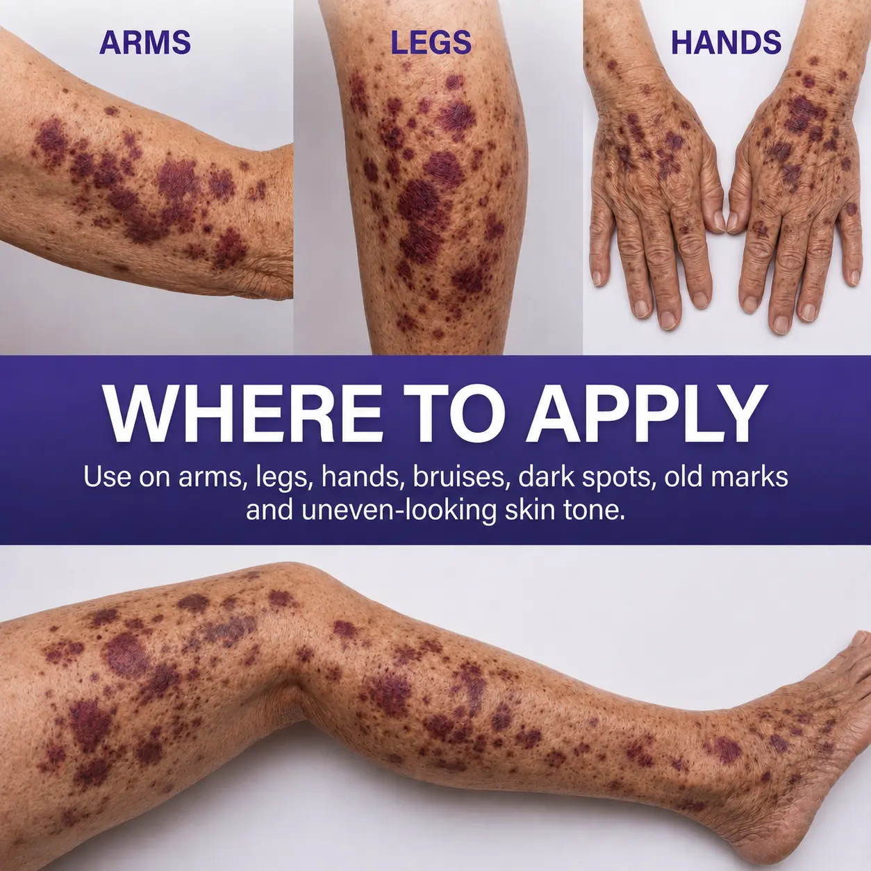 Newly Upgraded Dark Spot & Bruise Recovery Cream - Image 8