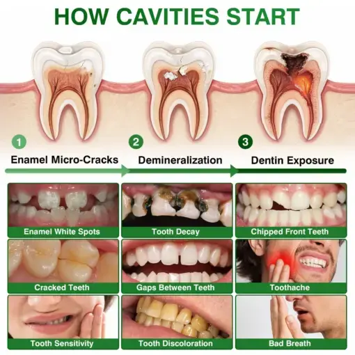 CavityReverse Pept11 MicroFill Gel - Image 5