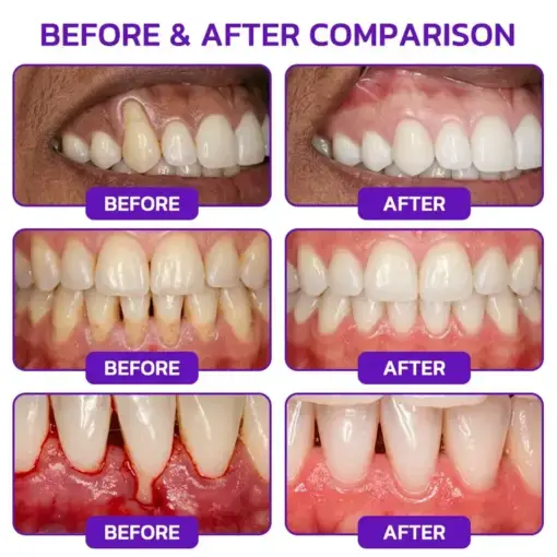 VioGum Gingivitis & Periodontal Rescue Gel - Image 2