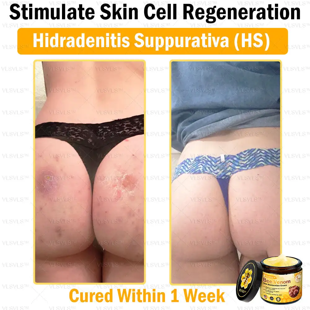 Bee Venom Skin Restoration Cream - Image 11